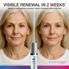 NMN+ Elite Anti-Aging Serum